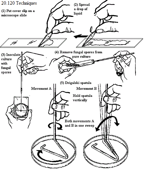 See diagram 20.120: Smear techniques