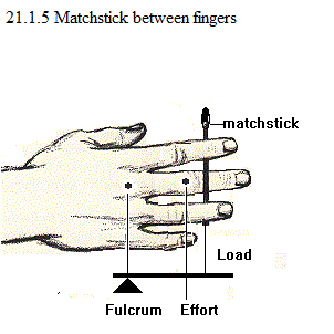 See diagram 21.1.5: Matchstick between fingers.