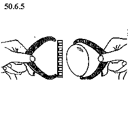 See diagram 50.6.9: Egg calipers