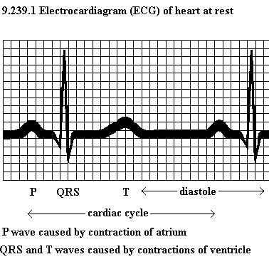 See diagram: 9.239.1: Electrocardiogram of heart at rest