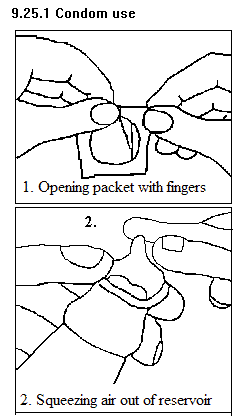 See diagram 9.25.1: Condom 1 and 2.