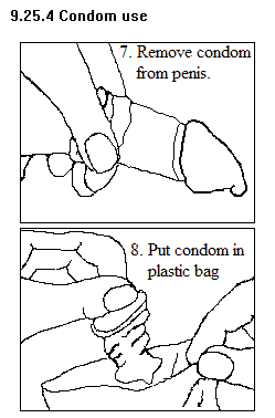 See diagram 9.25.4: Condom 7 and 8.